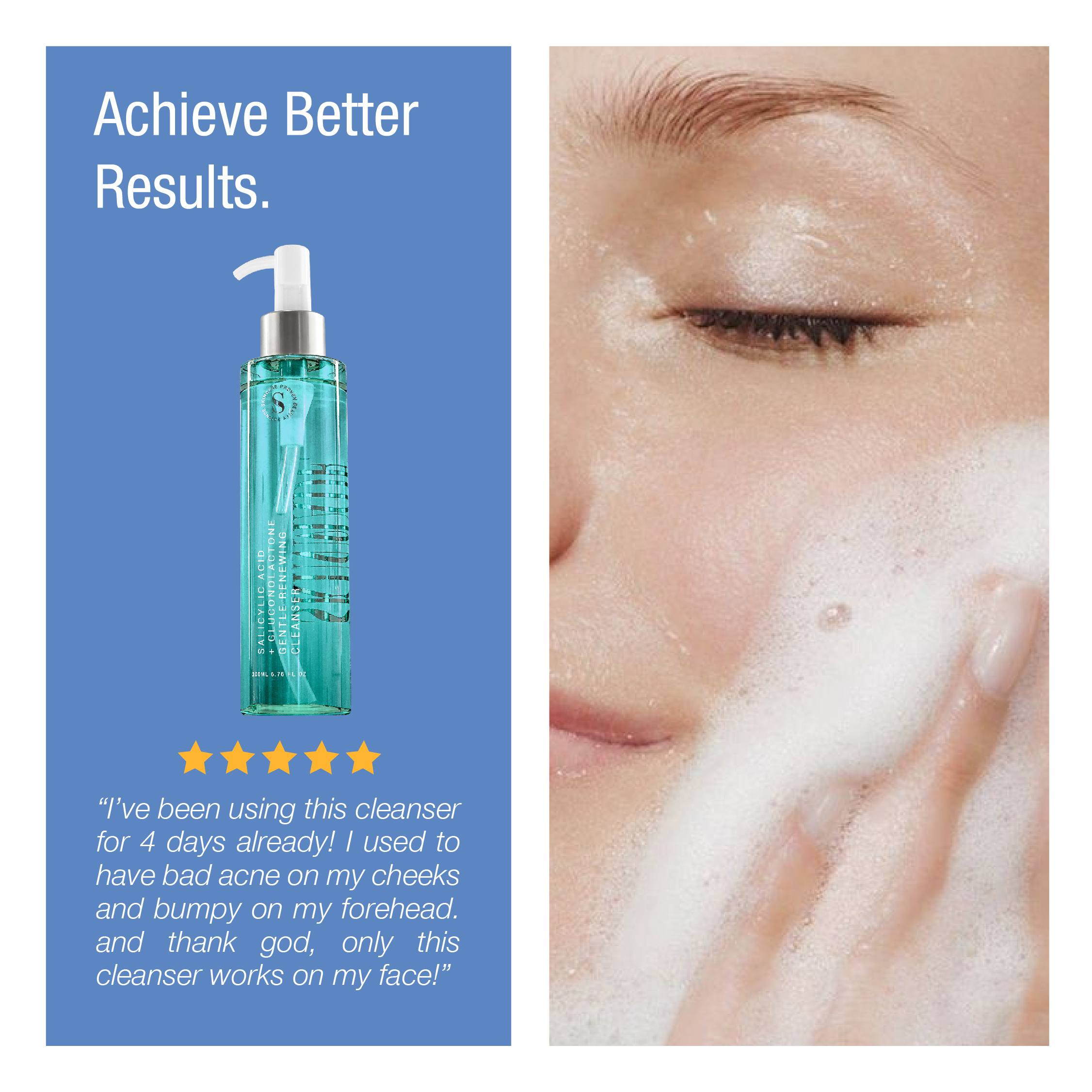 SKINMADE Basic Skincare Set Acne Prone & Oily Skin (3 Pcs) | Shopee ...