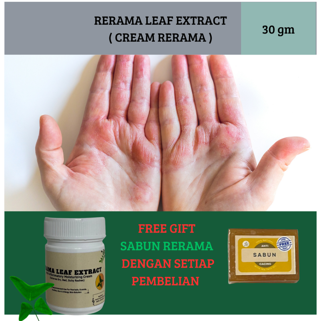 KRIM GATAL DAUN RERAMA - KULIT GATAL [30 GRAM]+ FREE GIFT+FREE SHIPPING ...