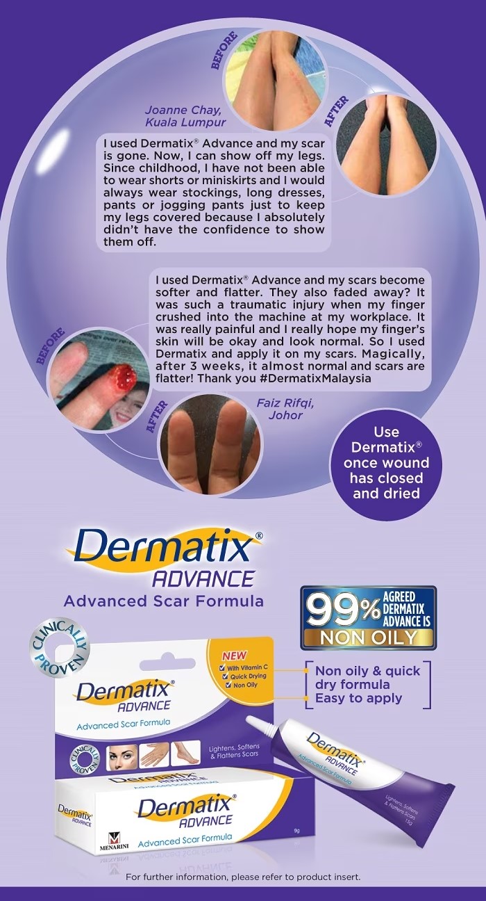 [PMG PHARMACY] Dermatix Advance Scar Gel 15g | Shopee Malaysia