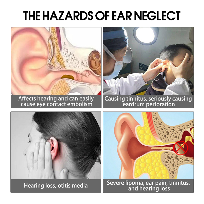 Earpick Smart Visual Camera Ear Scoop Baby Adult Intelligent ...