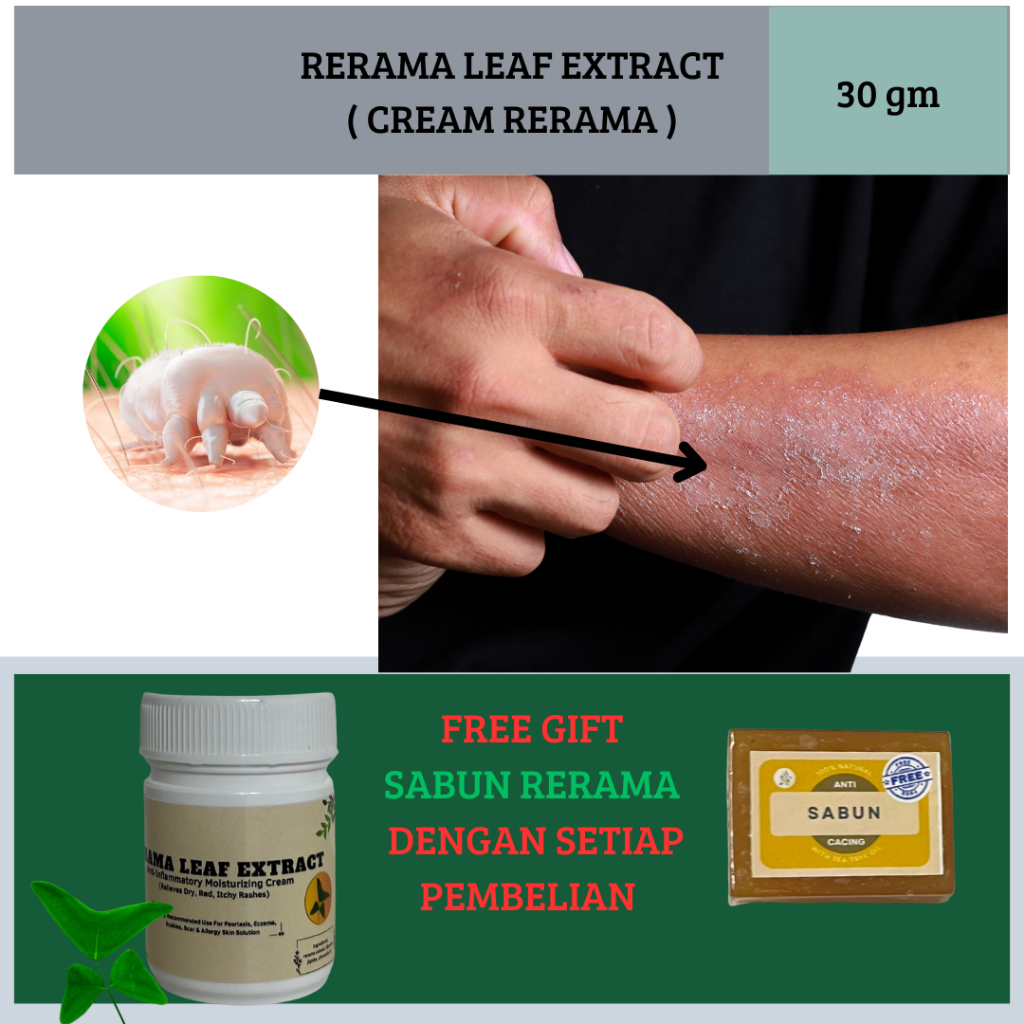 KRIM GATAL DAUN RERAMA - KULIT GATAL [30 GRAM]+ FREE GIFT+FREE SHIPPING ...