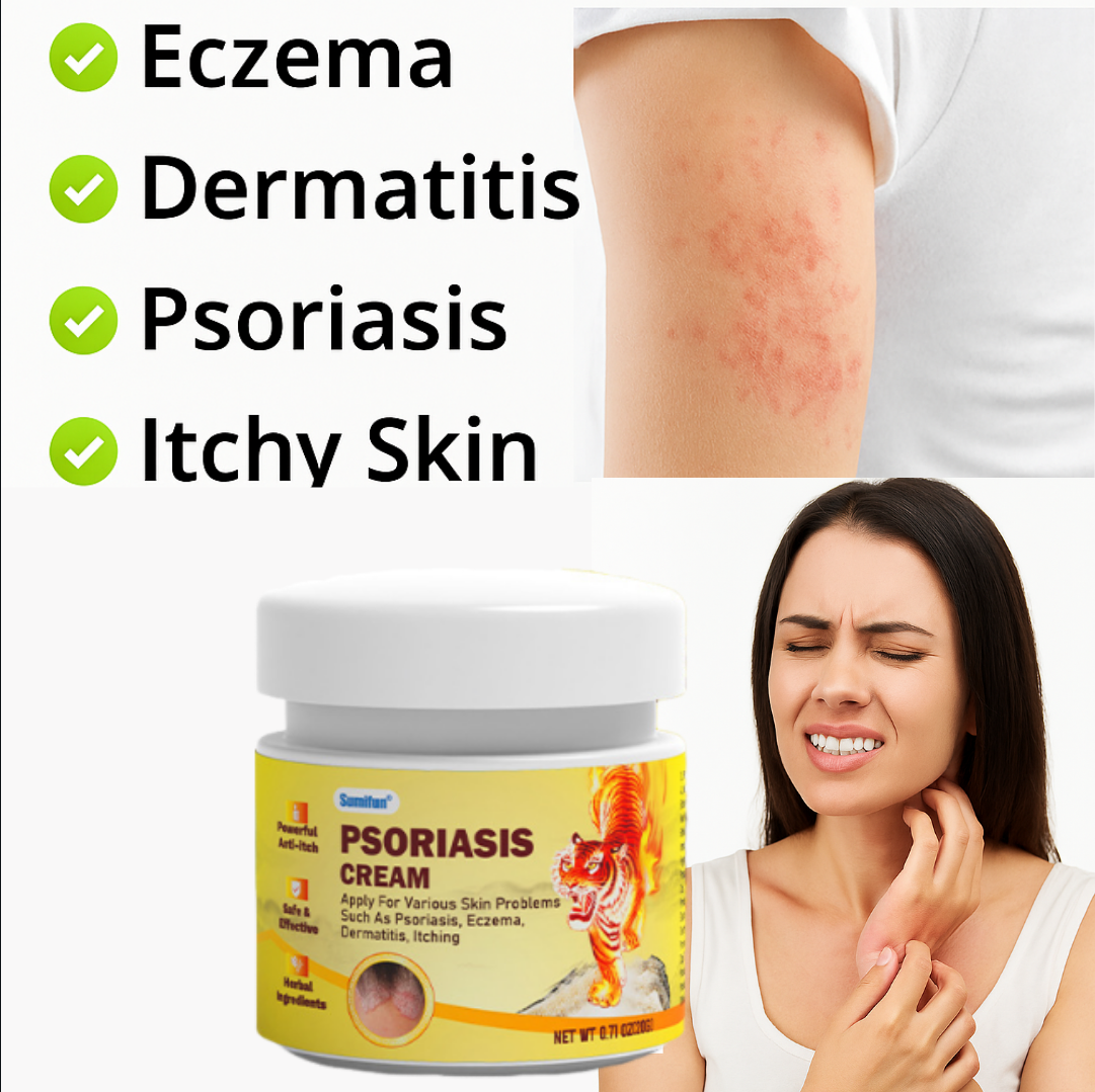 Sumifun psoriasis cream dermatitis Sensitive skin Tunea Pedis Ubat ...