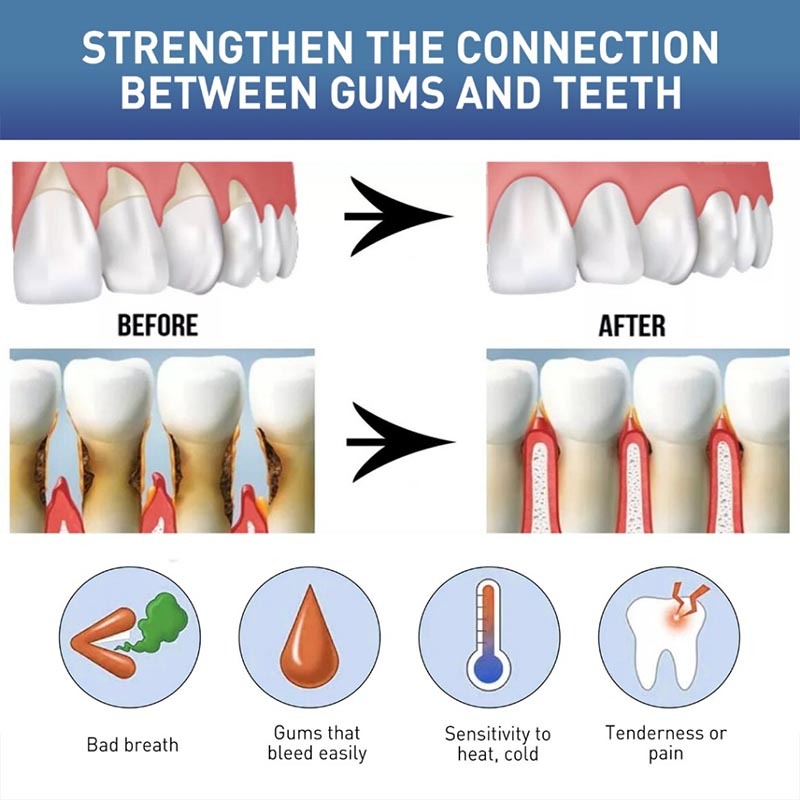 Instant Gum Soothing Gel For Receding Inflamed Gums Gum Repair Therapy ...