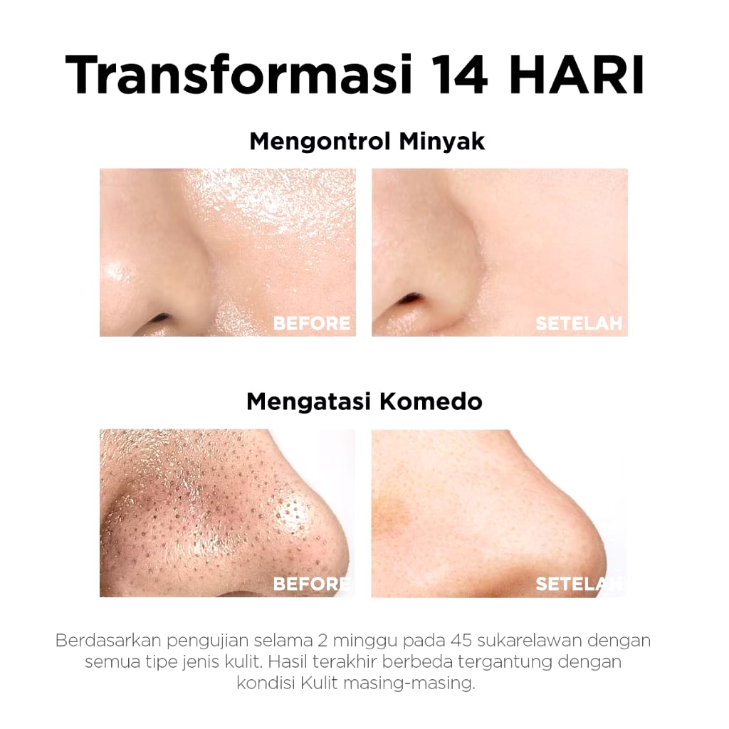 Focalskin AHA BHA PHA Bubble Cleanser Facial Wash Gentle Cleanser ...