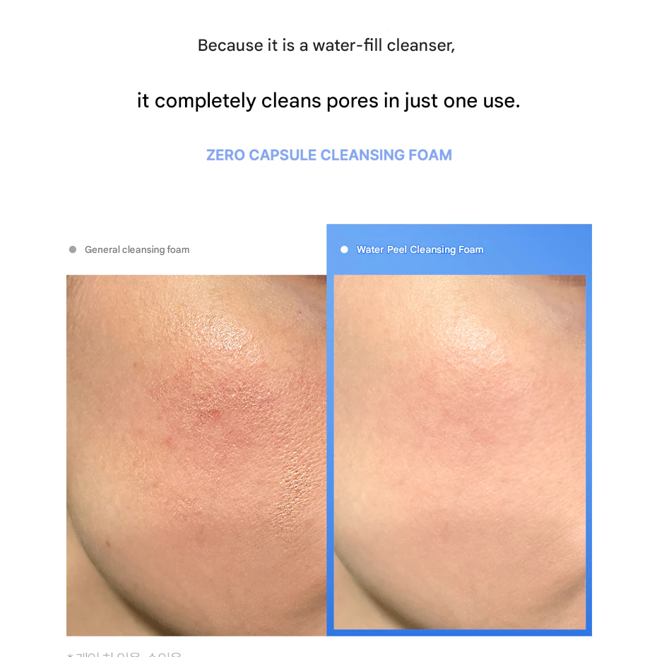 MEDICUBE Zero Pore Clearing Capsule Foam Cleanser / Blackhead Sebum ...