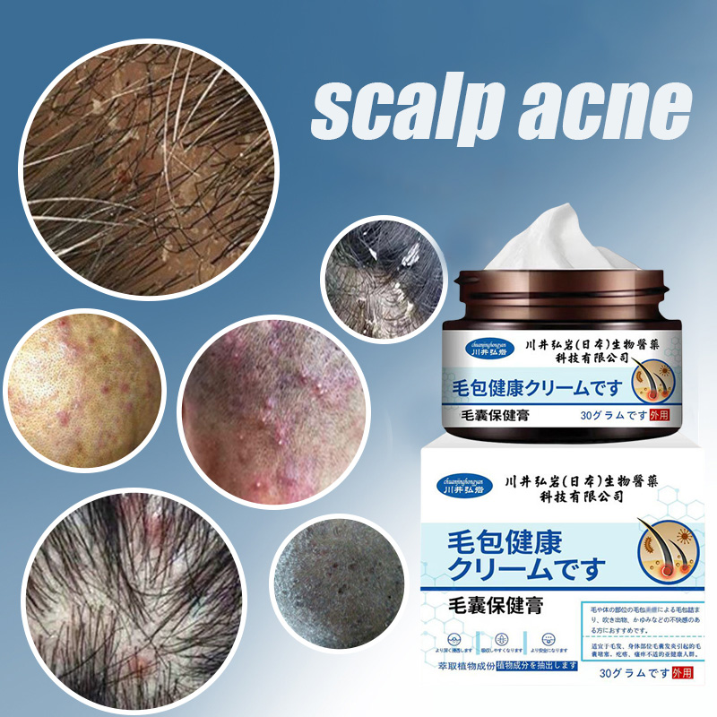Seborrheic dermatitis cream Scalp treatment psoriasis Folliculitis hair ...
