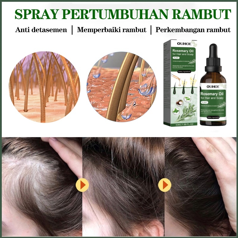 Minyak Lebatkan Rambut Hair growth serum Hair loss treatment serum ...