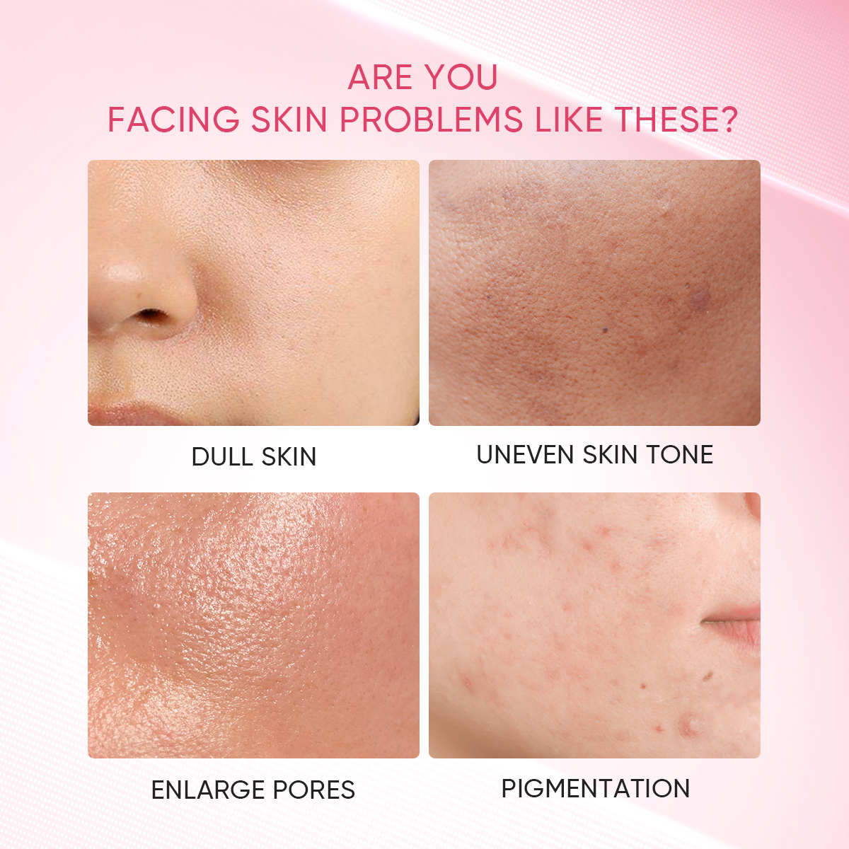 【BUY 1 RREE 1】SKINTIFIC Niacinamide Brightening，Mugwort Acne，Alaska ...