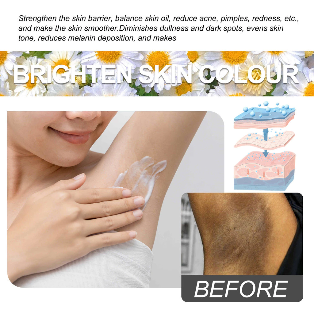 Inner Thigh Whitening Moisturizing Cream Lighten darkness underarm ...