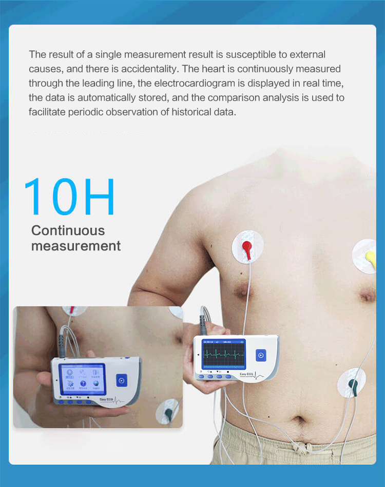 Lepu Medical Easy ECG Monitor Portable Handheld Electrocardiogram ...