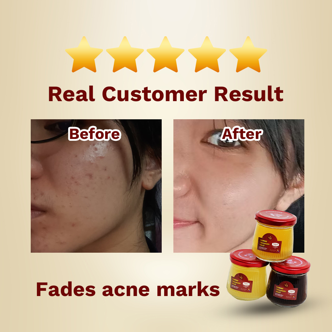 Scale Story рџђџ Lingji Fish Scale Collagen Jelly Promo Fish Skin