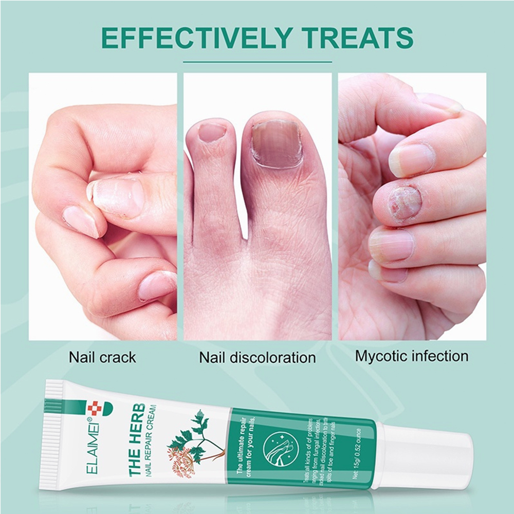 Nail repair Cream 15g Quick Repair DamagedNourishing nails, anti ...