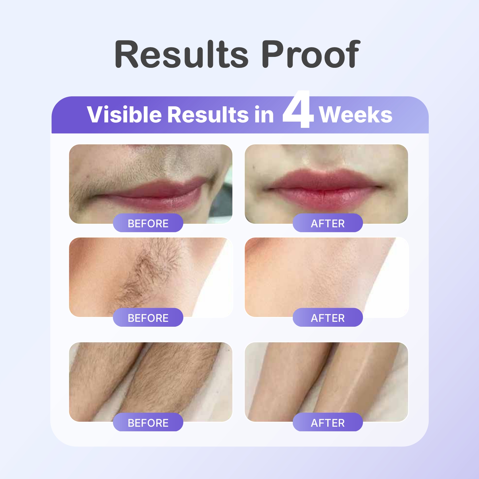 SKILLANO IPL Laser Hair Removal Machine 永久性激光IPL除毛仪 | Shopee Malaysia