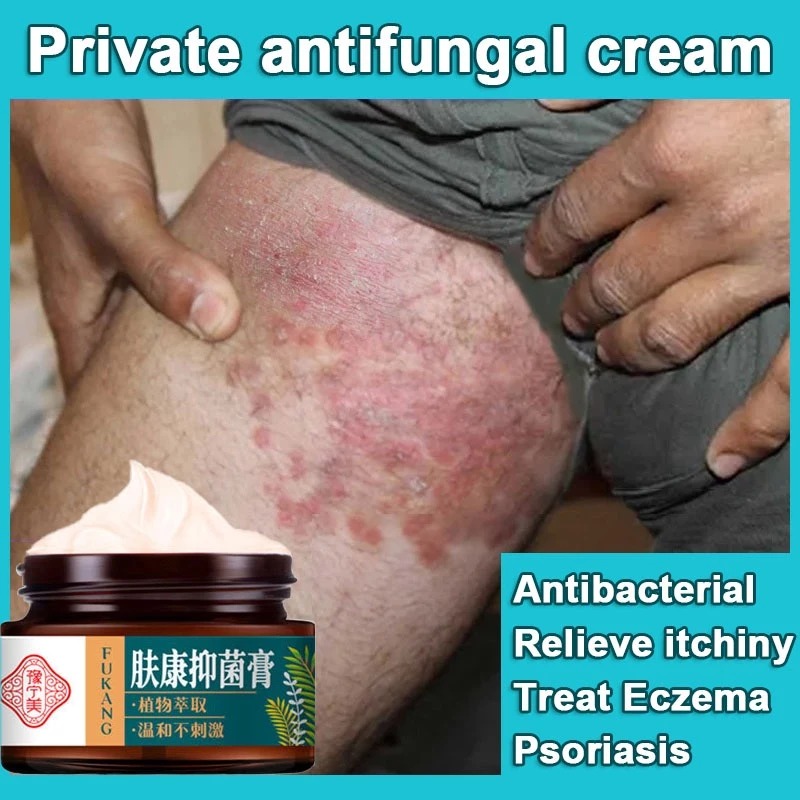 Eczema cream psoriasis cream treat itching private part itchy cream ...