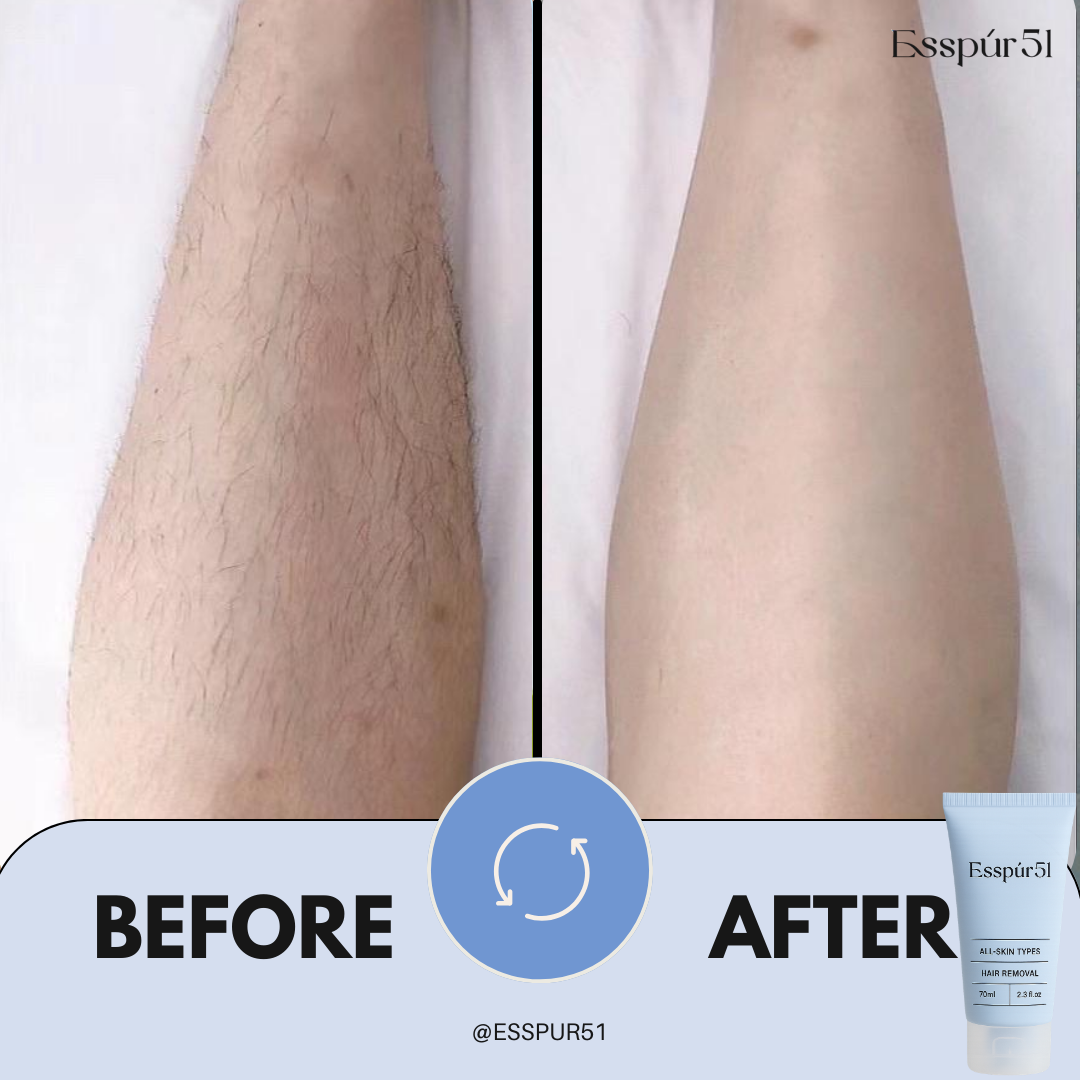【官方商店】Pure51 (Esspur51) 除毛膏 Hair Removal Cream 70G | Shopee Malaysia