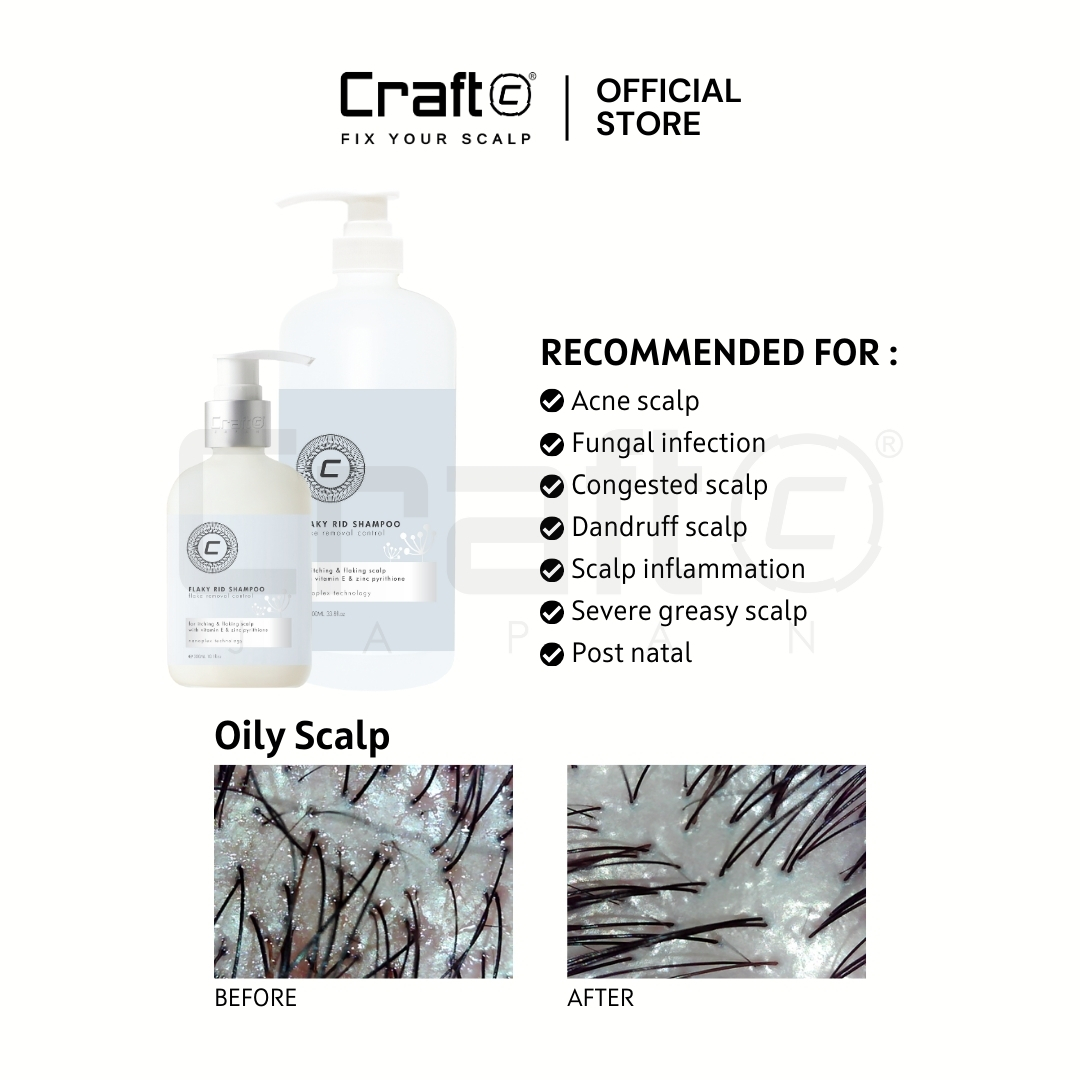 Craft Flaky Rid Shampoo | Shopee Malaysia