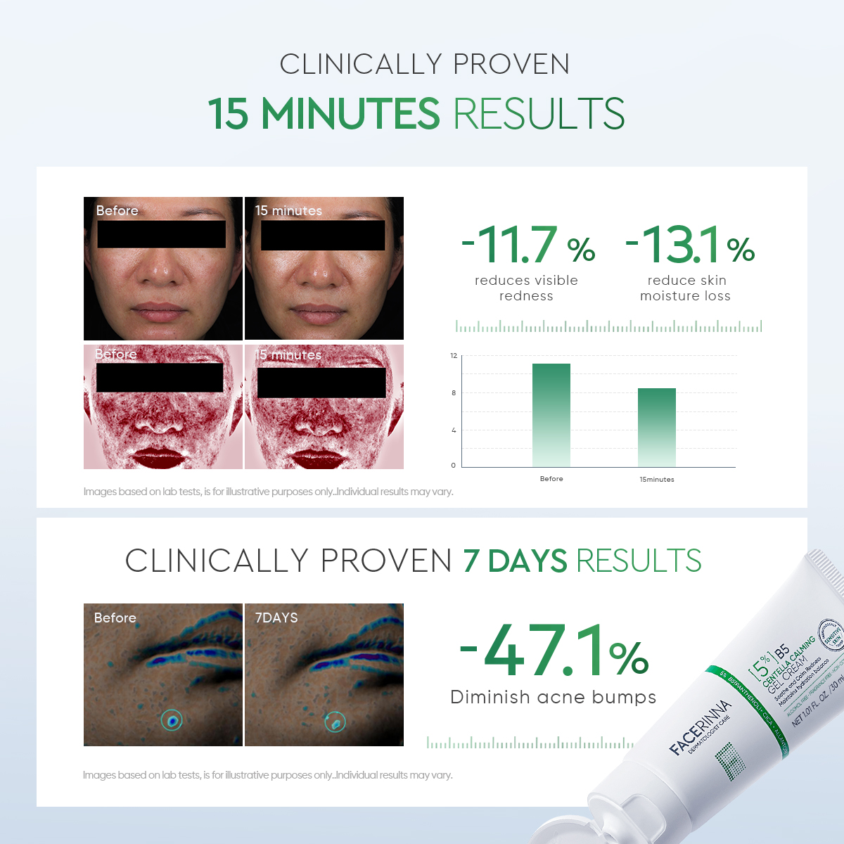[SOS CREAM] FACERINNA 5% B5 CENTELLA CALMING GEL CREAM SENSITIVE SKIN ...