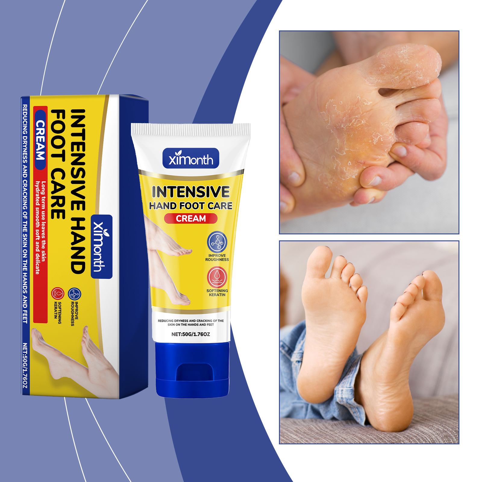 【🔥Ready Stock】Intensive Foot Care Cream 50g Intensive Hand Foot Care ...