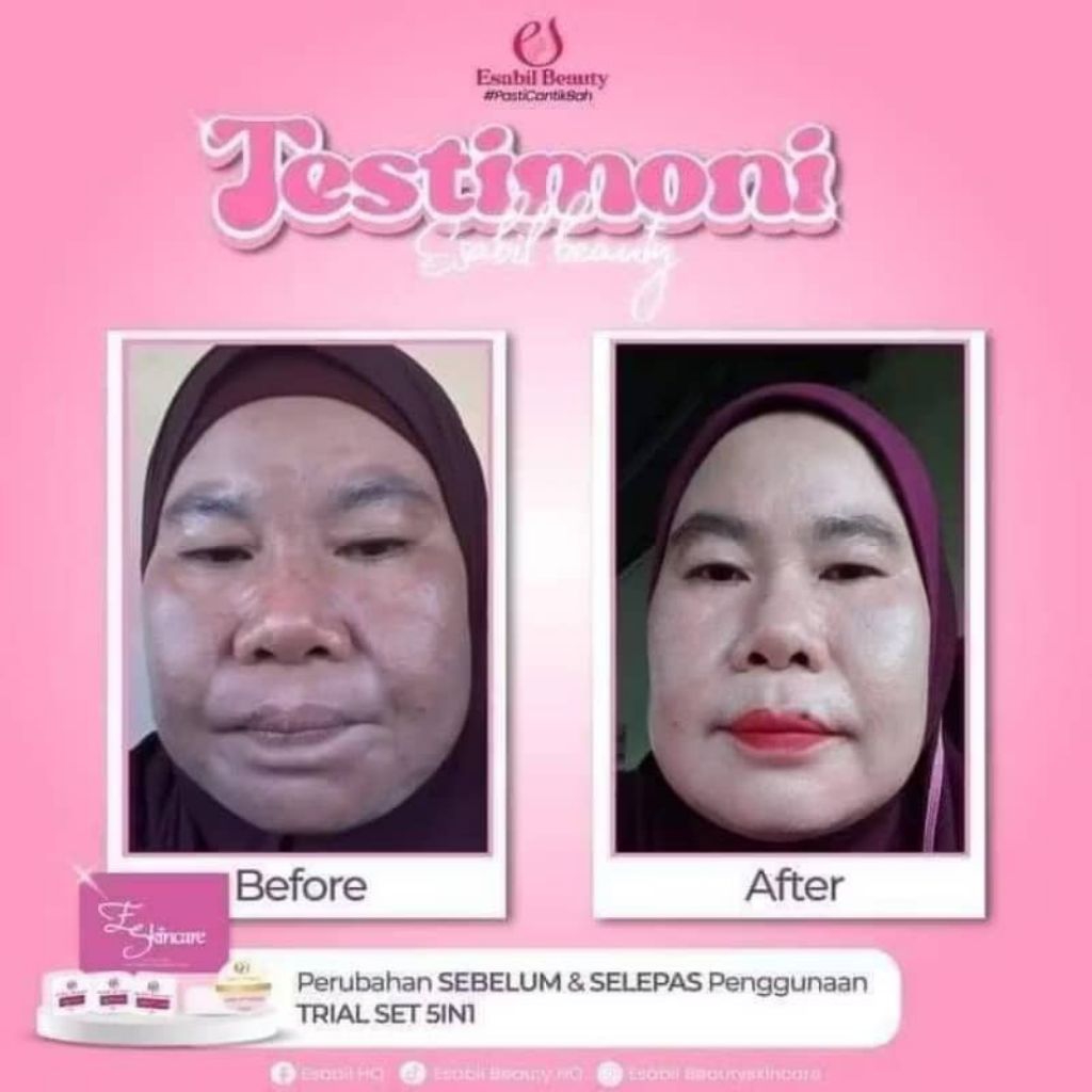💯original + FREE GIFT 🎁ESABIL TRIAL SKINCARE 6IN1 | Shopee Malaysia