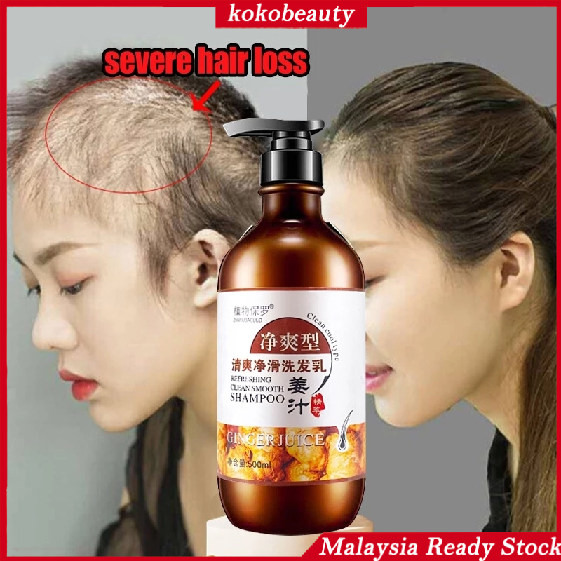 Anti-hair loss shampoo-rambut gugur-hair fall shampoo Rambut Pelebat ...