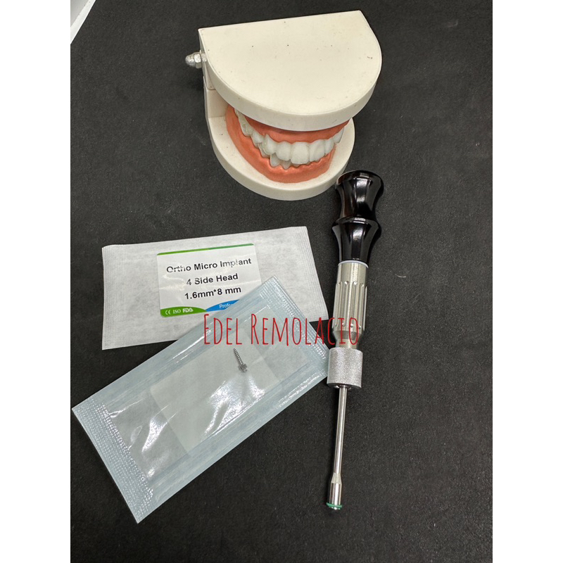 Temporary Anchorage Devices (tads) For Orthodontic Treatment 