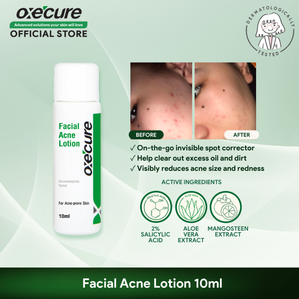 Oxecure 2 Salicylic Acid Facial Acne Lotion 10ml Shopee Malaysia 9624