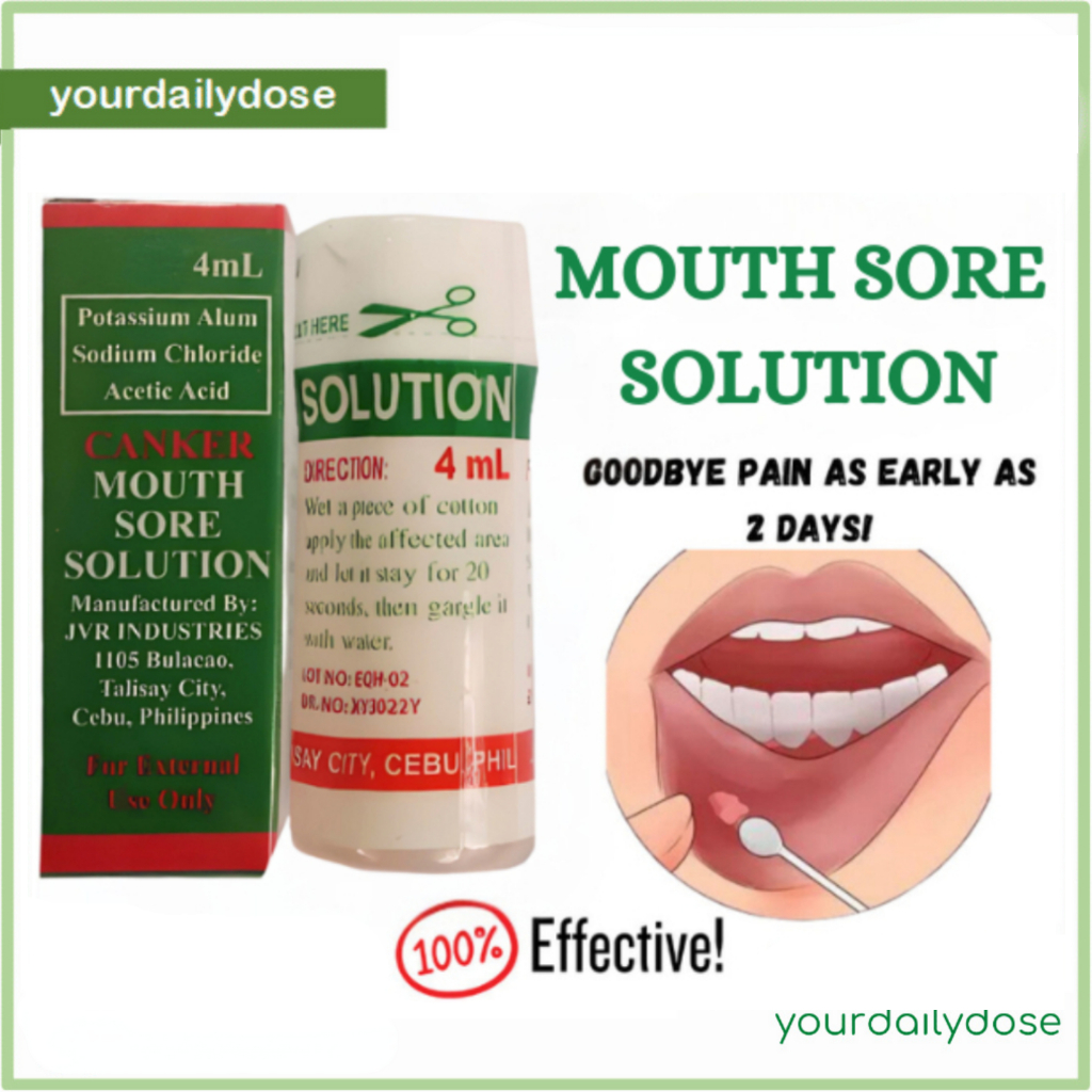 Canker Mouth Sore Solution Singaw Treatment | Shopee Malaysia