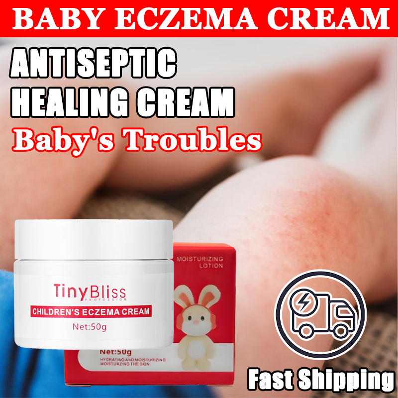 Tinybliss Cream For Itchi Skin For Baby Relief Baby Acne Nappy Rash ...