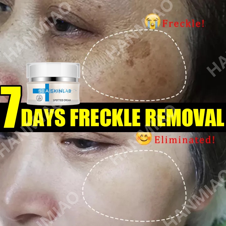 [ORIGINAL]Whitening pigmentation remover cream/krim jeragat 淡斑祛斑霜 ubat