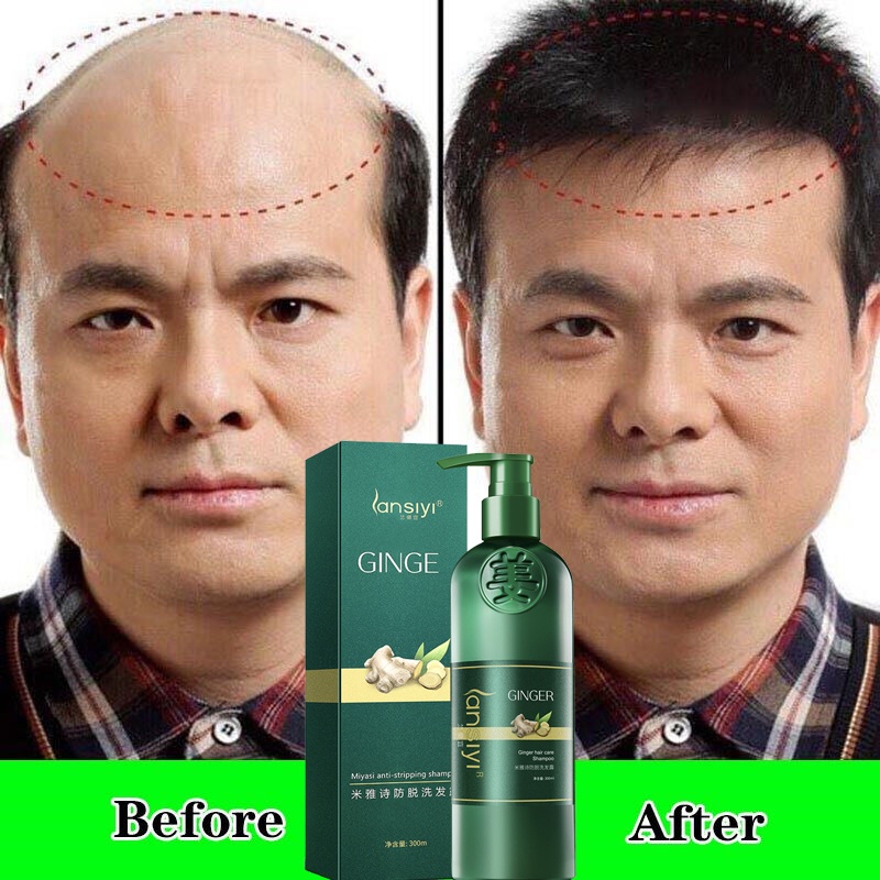 Ginger Hair Booster Shampoo Conditioner Treatment Scalp Rambut Pelebat ...