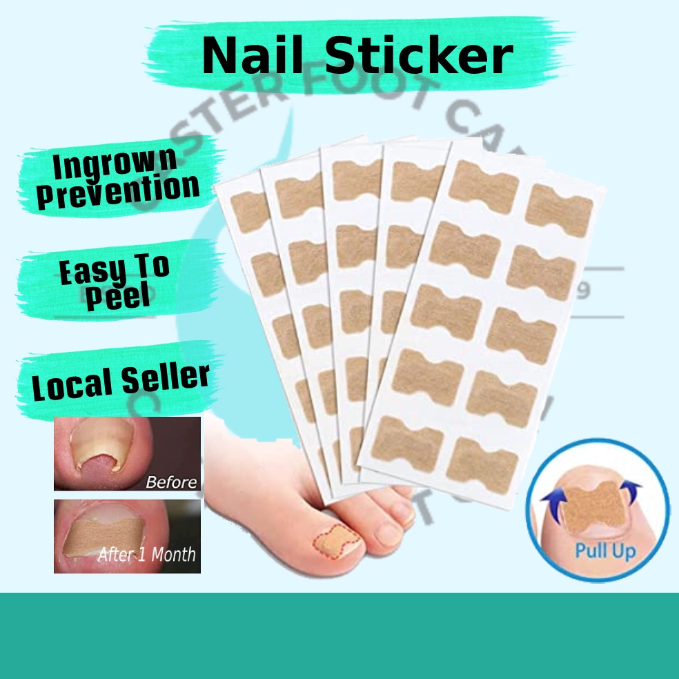 10 pcs Ingrown Toenail Correction Stickers, Elastic Patch Curved ...