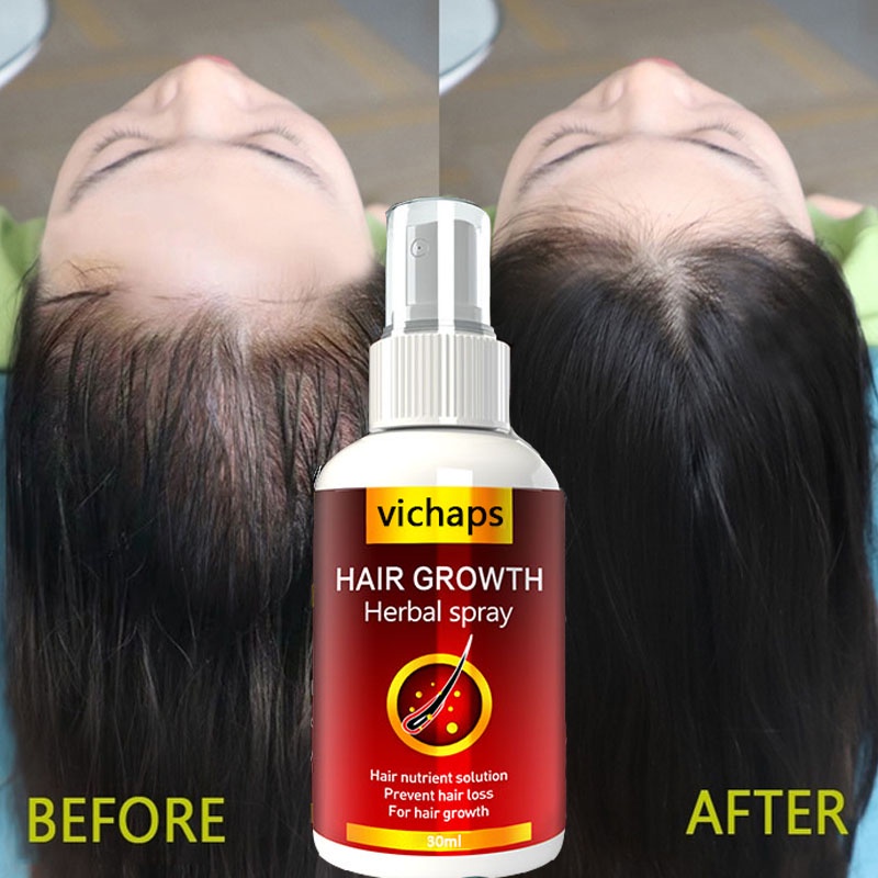 Hair Growth Serum Spray Fast Hair Growth Liquid Treatment Scalp Hair
