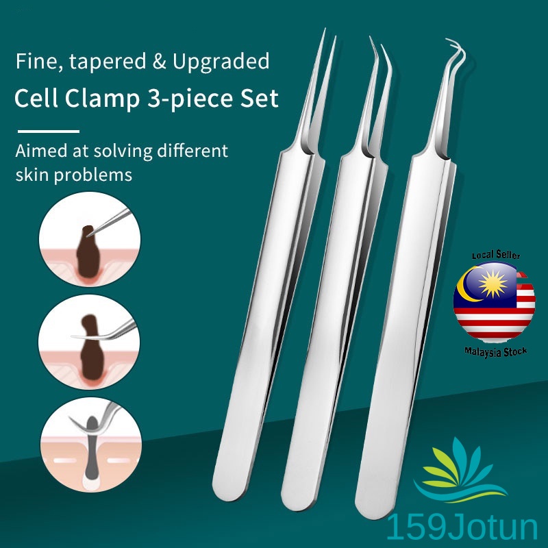 Blackhead Acne Pimple Clips Stainless Steel Pimple Extractor Remover ...