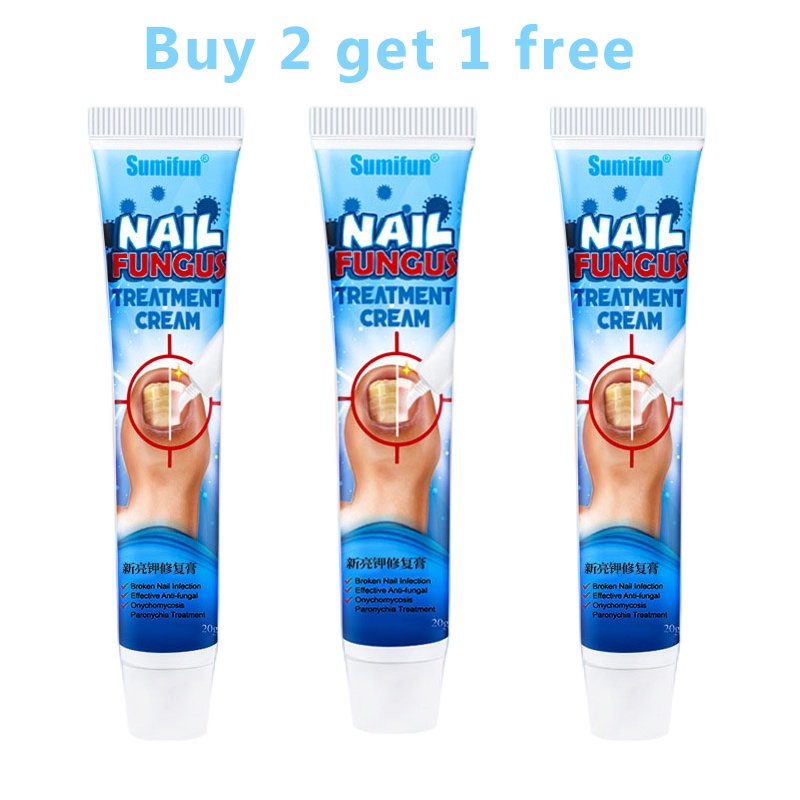 Nail cream nail fungus treatment anti fungal nail cream Krim KUKU Anti