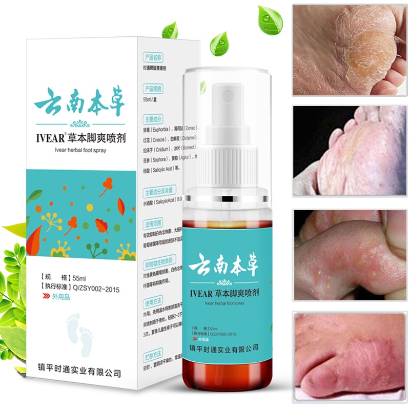Instant Athlete's Foot Spray Herbal Anti Fungal Relieve Beriberi Cream