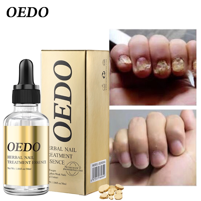 OEDO Nail Repair Essence Serum (30ml) Shopee Malaysia