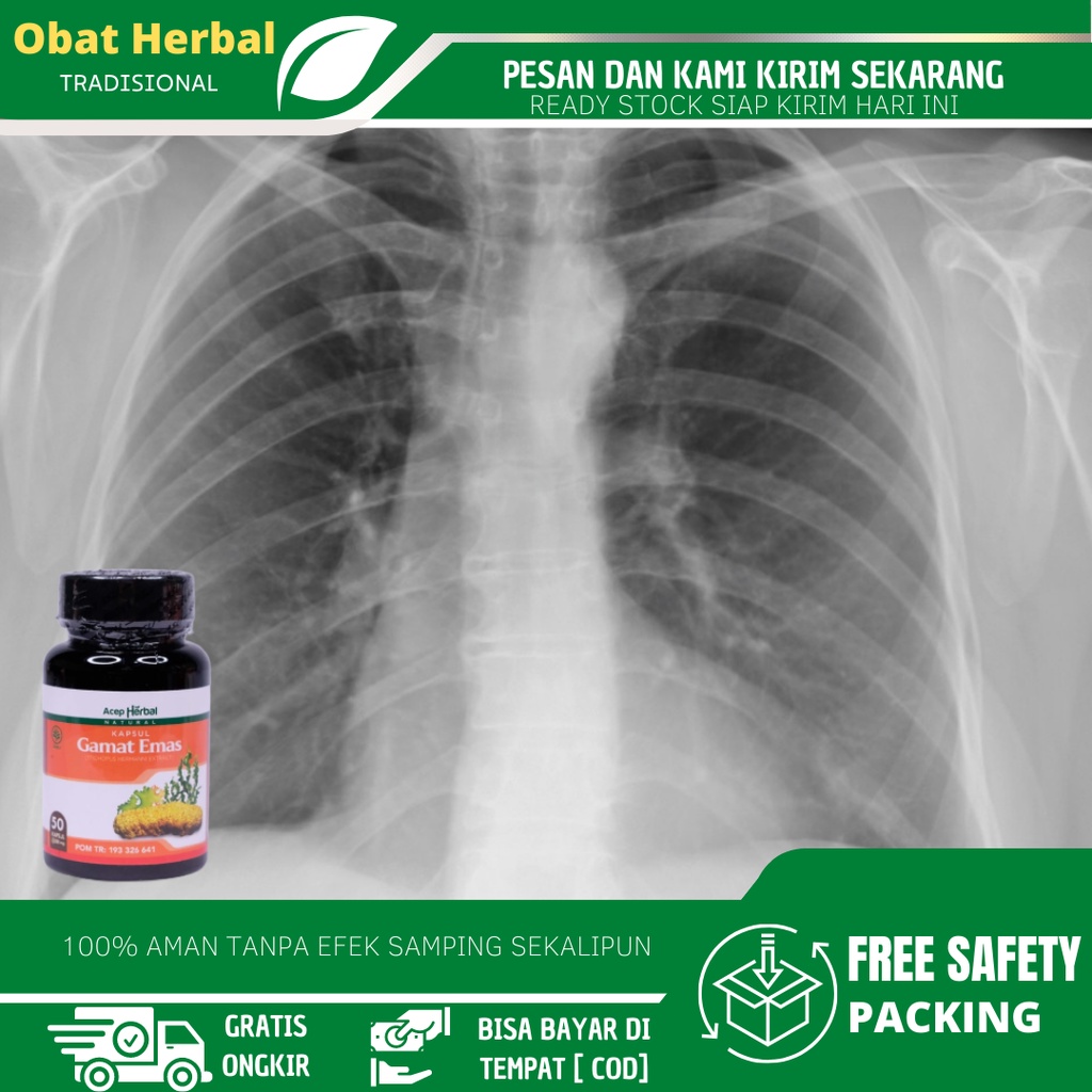 Herbal Medicine For Cleaning Lungs, Lung Spots, Lung Slime Cleanser, Tb