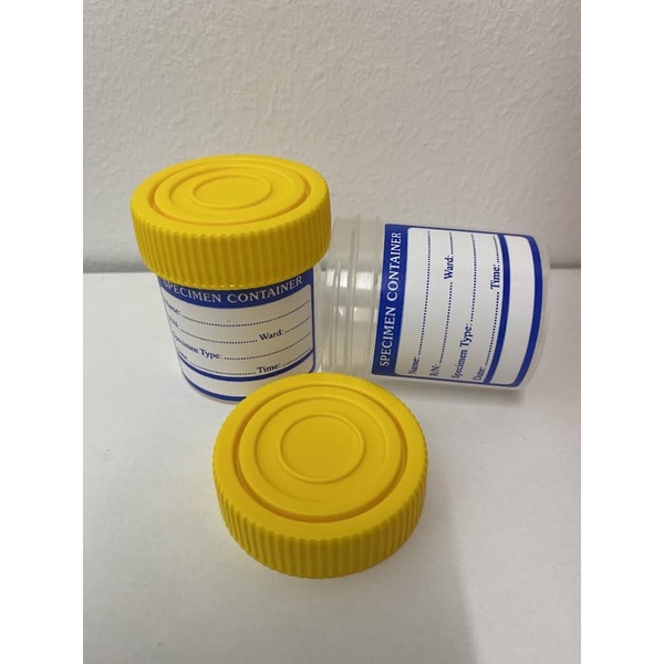 Urine Container Yellow Cap 60ml/pcs | Shopee Malaysia