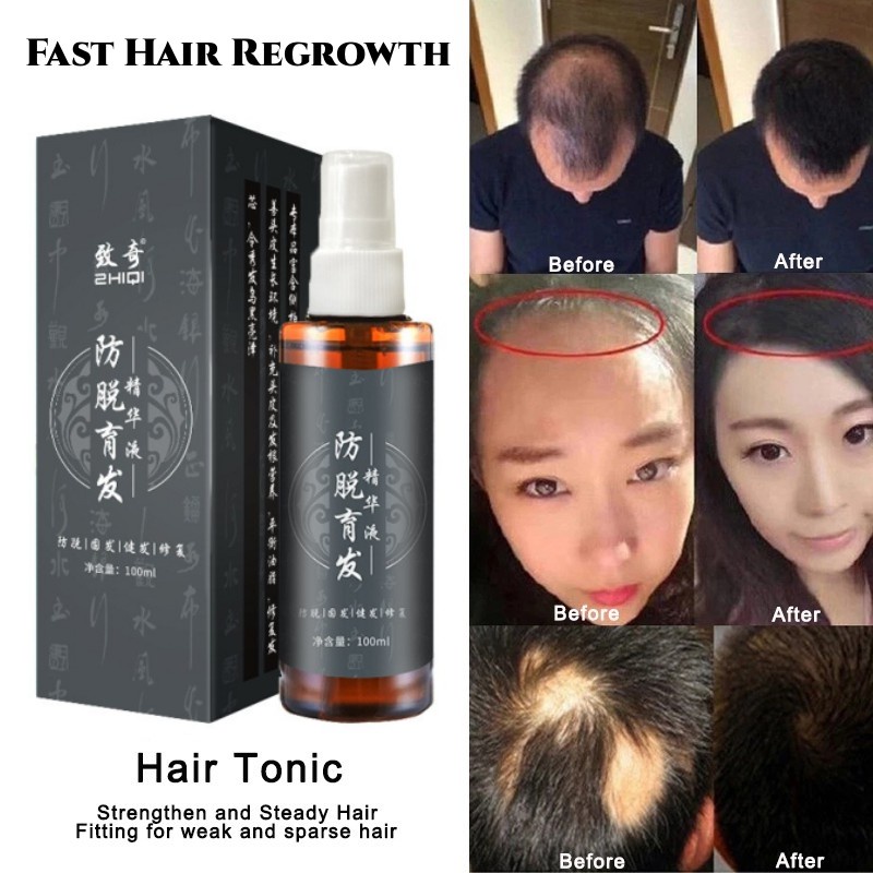 Ginger Hair Growth Serum Arborvitae Hair Tonic Plant Essence Thicker