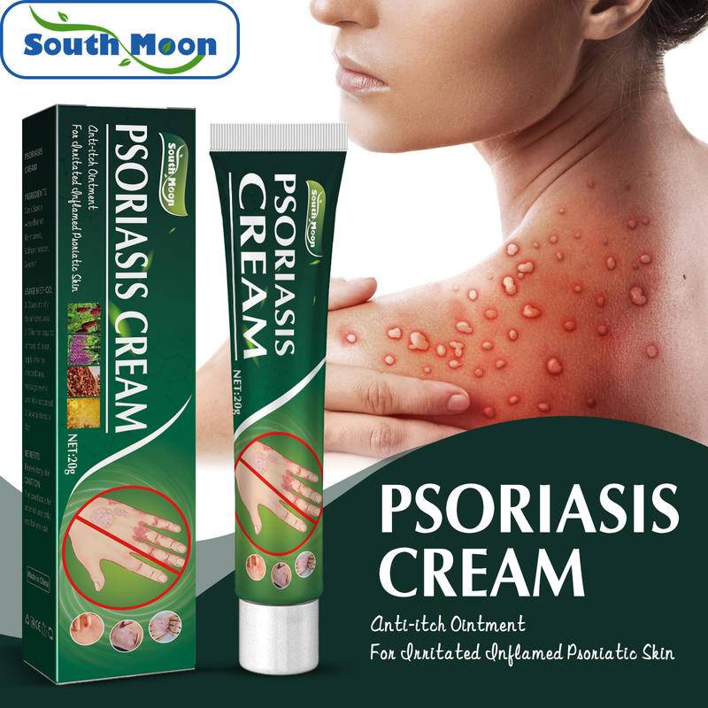 South Moon Psoriasis Cream Eczema Ointment Scalp Psoriasis Hand Tinea