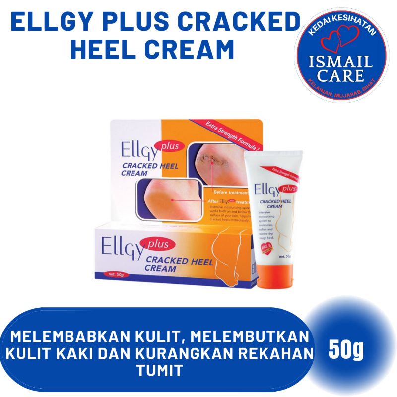 ELLGY PLUS CRACKED HEEL CREAM Shopee Malaysia
