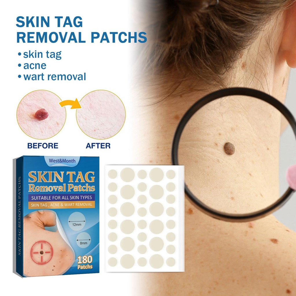 180 Patches Skin Tag Remover Patch Wart Treatment Stickers Quick Absorb ...
