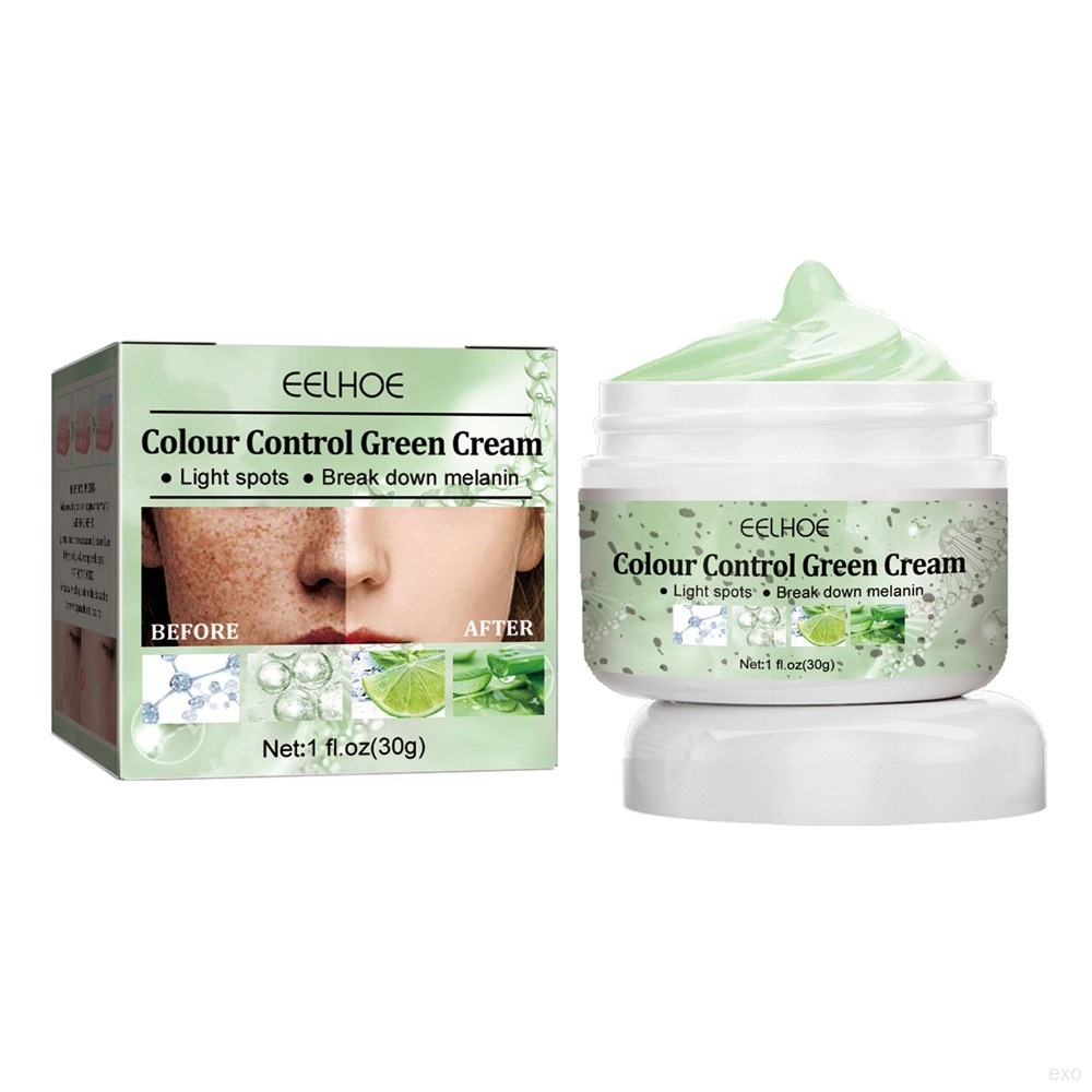 Whitening Dark Spots Fading Cream Freckle Remove Pimple Scars Melanin ...