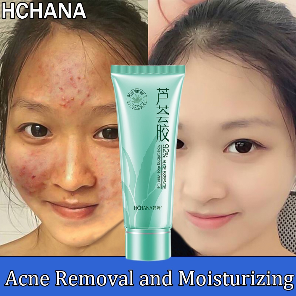 Dermatix Advanced Scar Formula Acne Scar Cream Keloid Scar Remover Krim