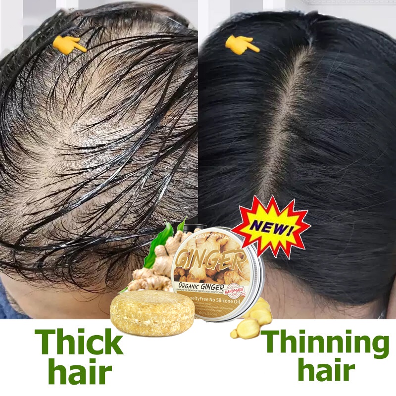 Ginger Germinal Oil Hair Growth shampoo bar Hair Loss Treatment 60g