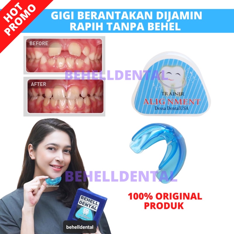 Original BEHELLDENTAL TEETH TOOL / STRAIGHTENER WITHOUT BEHEL / TEETH ...