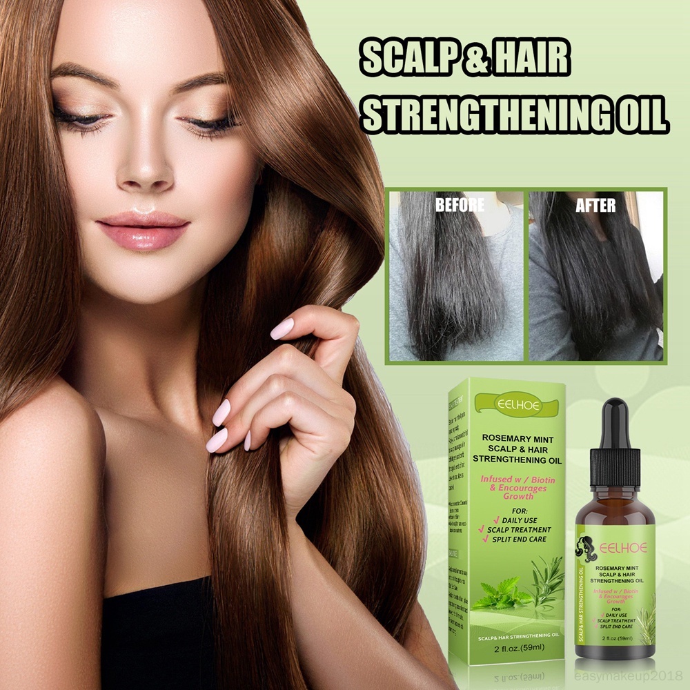 Hair Care Essential Oil Antis Alopecia Heal The Dry And Withered Anti ...