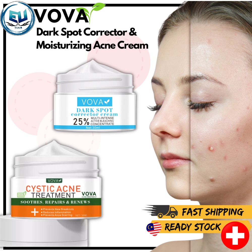 READY STOCK VOVA Effective Whitening Freckle Cream Remove Melasma Acne