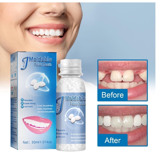 Gigi Palsu/Temporary tooth repair kit teeth(Ready stock) | Shopee Malaysia