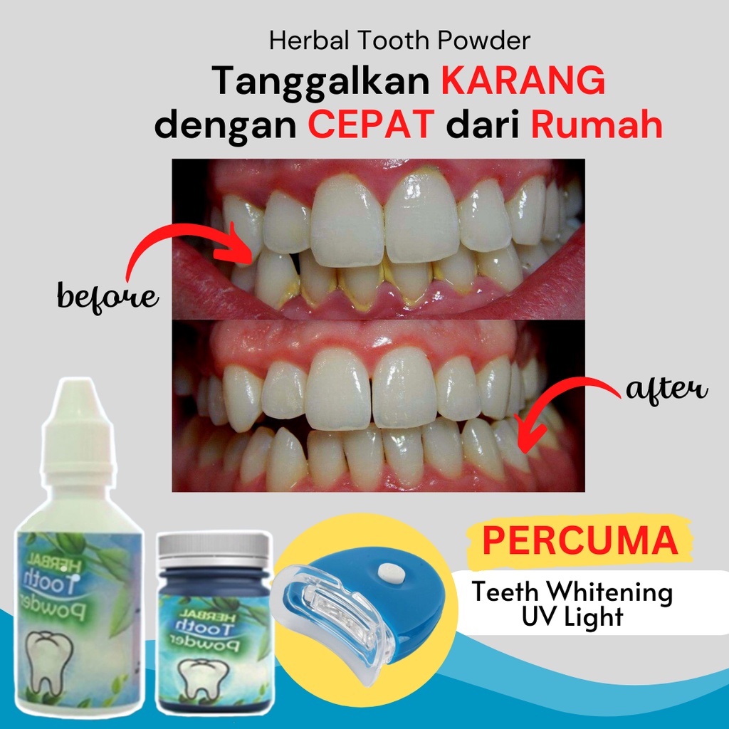 Ubat Buang Karang Gigi Pemutih Gigi Oral Teeth Whitening Herbal Tooth Powder Hilangkan Karat